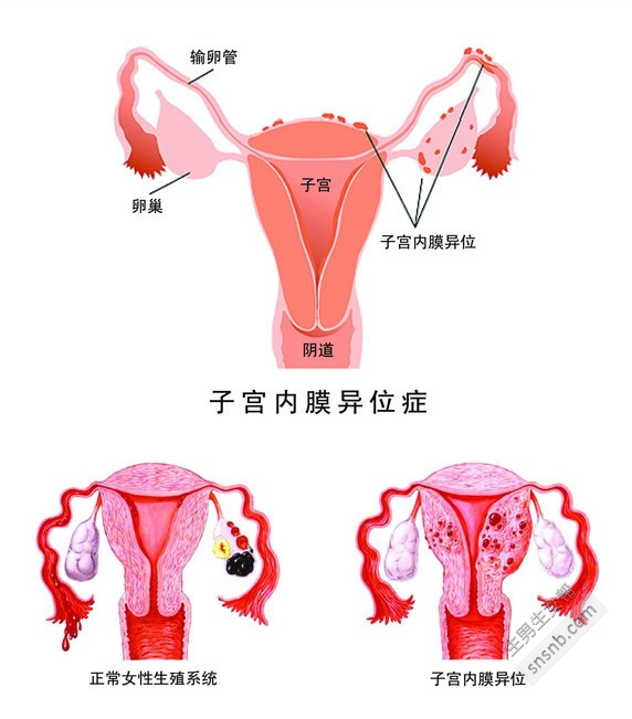 如果我的输卵管不工作，我应该怎么做？医生告诉你3种方法来弥补怀孕和生育之间的差距!